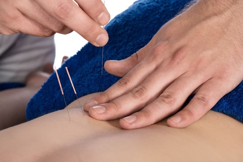 dry needling